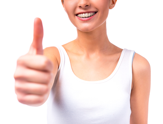 What To Know Before Getting Damon Braces